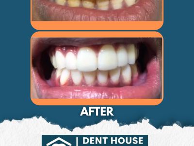 Dr. Khushboo Dent house dental clinic in Mumbai, India, photograph 16