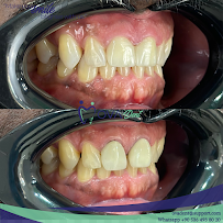 Alanya Ovadent Dental Clinic