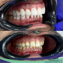 Alanya Ovadent Dental Clinic
