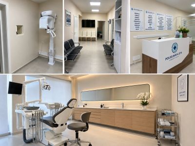 DentWay, all on 4 dental implants in Tirana