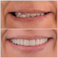 Dr. Cem Baysal | Dental Clinic Turkey | 33 Years Of Experience