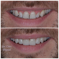 Dr. Cem Baysal | Dental Clinic Turkey | 33 Years Of Experience