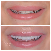 Dr. Cem Baysal | Dental Clinic Turkey | 33 Years Of Experience
