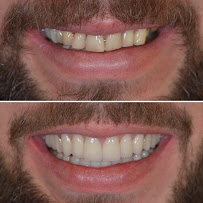 Dr. Cem Baysal | Dental Clinic Turkey | 33 Years Of Experience