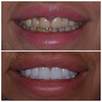Dr. Cem Baysal | Dental Clinic Turkey | 33 Years Of Experience