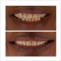 Dr. Cem Baysal | Dental Clinic Turkey | 33 Years Of Experience