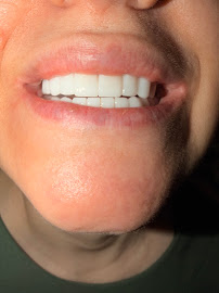 Dental World TR - Diş Kliniği