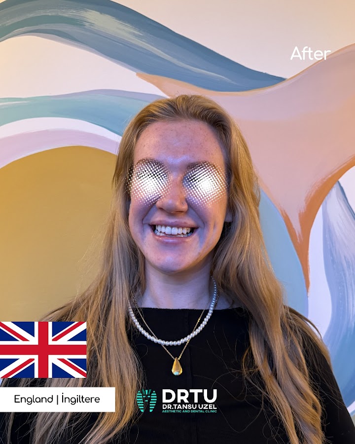 DRTU | DR. TANSU UZEL Dental Implant, Smile Design & Maxillofacial Surgery Istanbul