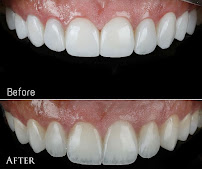 DRTU | DR. TANSU UZEL Dental Implant, Smile Design & Maxillofacial Surgery Istanbul