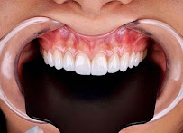 DRTU | DR. TANSU UZEL Dental Implant, Smile Design & Maxillofacial Surgery Istanbul