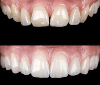 DRTU | DR. TANSU UZEL Dental Implant, Smile Design & Maxillofacial Surgery Istanbul