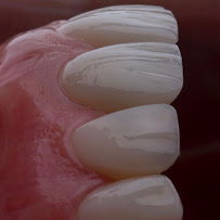 DRTU | DR. TANSU UZEL Dental Implant, Smile Design & Maxillofacial Surgery Istanbul
