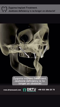 DRTU | DR. TANSU UZEL Dental Implant, Smile Design & Maxillofacial Surgery Istanbul