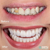 DRTU | DR. TANSU UZEL Dental Implant, Smile Design & Maxillofacial Surgery Istanbul