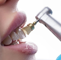 Best Dental İstanbul | Veneers | Implants | Crowns