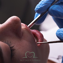 Best Dental İstanbul | Veneers | Implants | Crowns