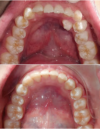 Smileage Dental Clinic KL