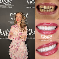 Dental Estetik