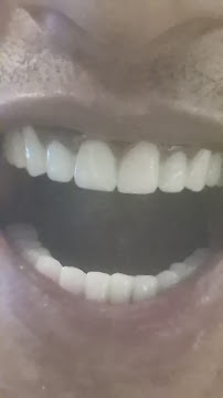 Dental Estetik