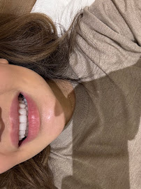 Dental Estetik