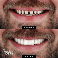 Denta İstanbul Diş Kliniği | Denta Istanbul Clinic | Dental Implants & Dental Veneer & Smile Design