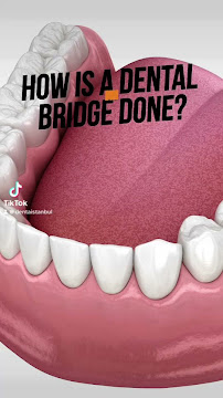 Denta İstanbul Diş Kliniği | Denta Istanbul Clinic | Dental Implants & Dental Veneer & Smile Design