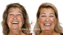 Karaçor Clinics | Smile Design | Laminate Veneer | Emax | Gülüş Tasarımı | Implant | Dentist | Adem Can Karaçor | Olcay Bakar