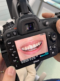 Karaçor Clinics | Smile Design | Laminate Veneer | Emax | Gülüş Tasarımı | Implant | Dentist | Adem Can Karaçor | Olcay Bakar
