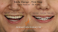 Karaçor Clinics | Smile Design | Laminate Veneer | Emax | Gülüş Tasarımı | Implant | Dentist | Adem Can Karaçor | Olcay Bakar