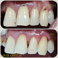 Viva Dental Clinic