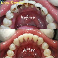 Viva Dental Clinic