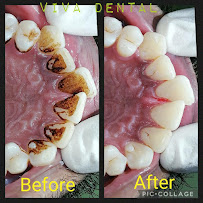Viva Dental Clinic