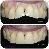 Viva Dental Clinic