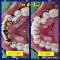 Viva Dental Clinic