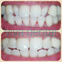 Viva Dental Clinic