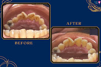 Smile Hub Dental KL Clinic