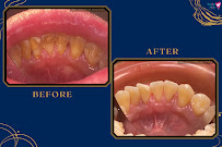 Smile Hub Dental KL Clinic