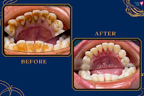 Smile Hub Dental KL Clinic