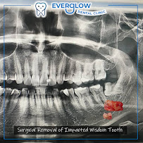 Everglow Dental Clinic