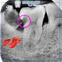 Everglow Dental Clinic