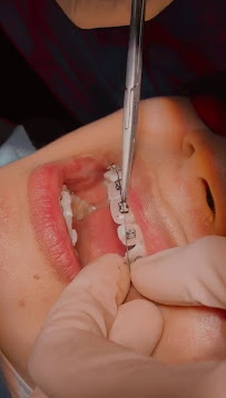 Hi-Dentist Cheras | Dental Clinic Alam Damai, Cheras
