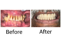 Hi-Dentist Cheras | Dental Clinic Alam Damai, Cheras