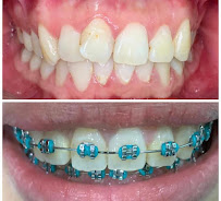 Hi-Dentist Cheras | Dental Clinic Alam Damai, Cheras