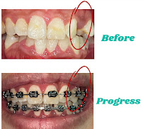 Hi-Dentist Cheras | Dental Clinic Alam Damai, Cheras