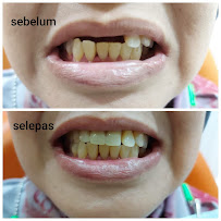 Klinik Pergigian Parmjit - Dental Clinic in Sentul