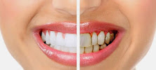 Dentists Özlem Özcan
