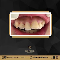 Klinik Pergigian Refine Dental