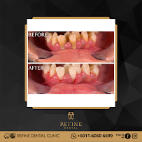 Klinik Pergigian Refine Dental