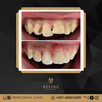 Klinik Pergigian Refine Dental