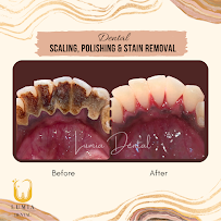 Lumia Dental Cheras 雪亮牙科诊所